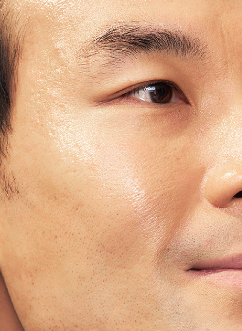 Foto do rosto do paciente SKINVIVE®, além de um close de seus olhos e bochechas, com a pele macia e radiante.