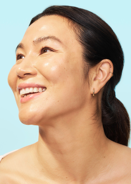 Foto de rosto e depoimento de um paciente real de SKINVIVE® (Mulher, 38).